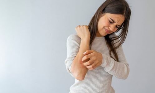 Everything you need to know about psoriasis - Healthista